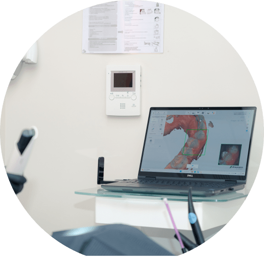 Empreinte optique au CABINET DU NOUVEAU SOURIRE à Lambersart