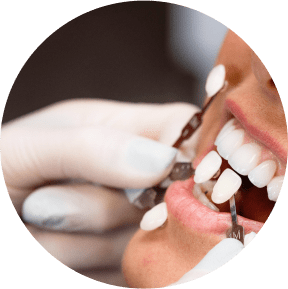 esthetique dentaire au CABINET DU NOUVEAU SOURIRE à Lambersart